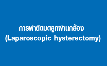 การผ่าตัดมดลูกผ่านกล้อง (Laparoscopic hysterectomy)